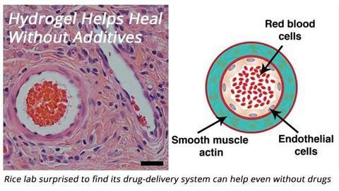 Drug-Delivery System Can Help Heal Even Without Drugs
