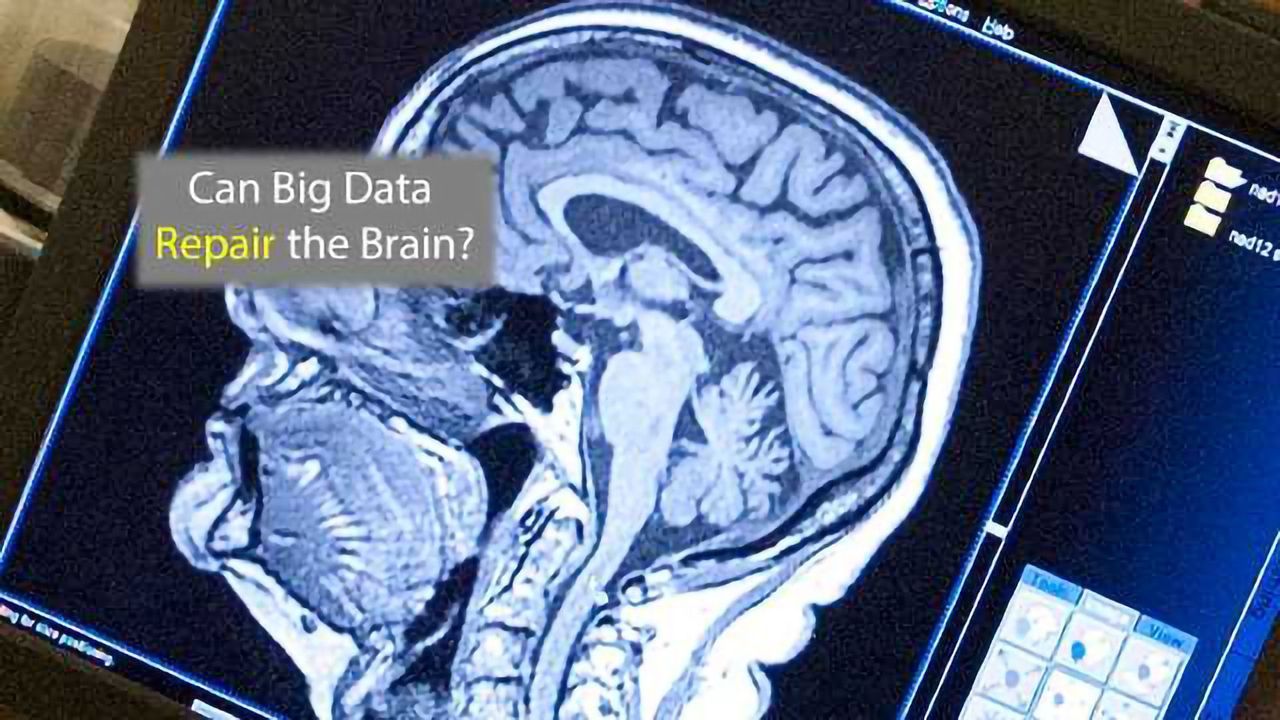 Brain Repair Requires a Big Data Approach