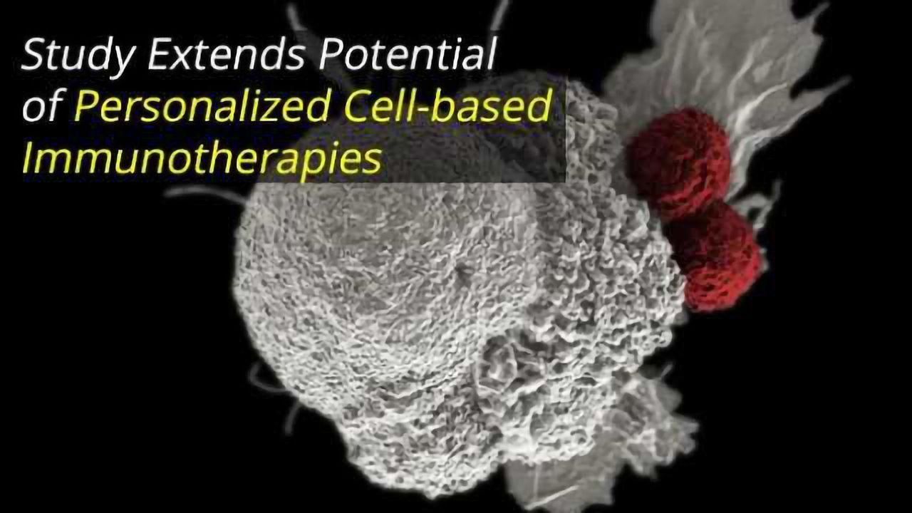 Study Extends Potential of Personalized Cell-based Immunotherapies