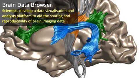 Researchers Democratize Neuroscience by Making it Easier to Share Brain Imaging Data