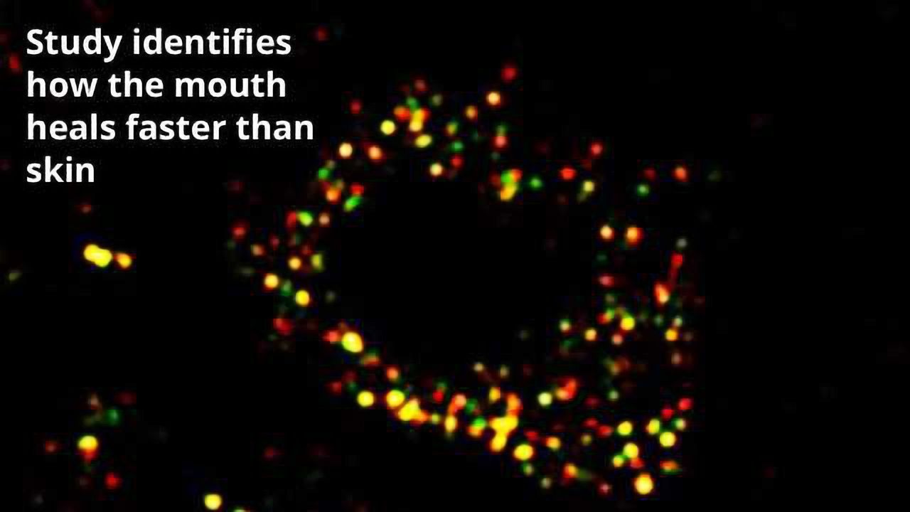 Unraveling How Mesenchymal Stem Cells From Gum Tissue Accelerate Wound Healing
