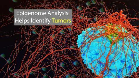 Epigenomics to Enhance Tumor Classification