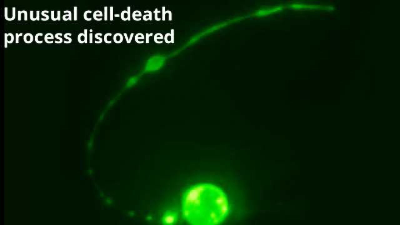 What Happens to a Dying Cell’s Corpse?