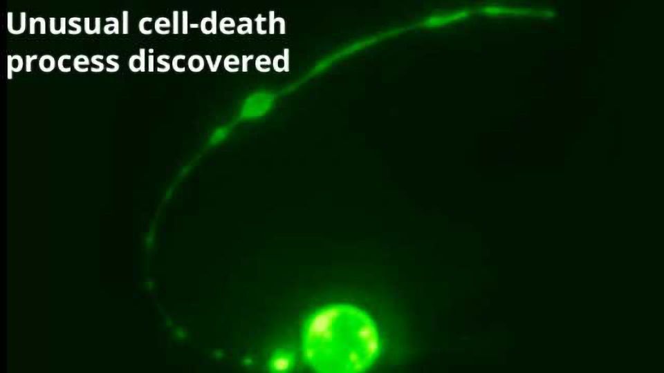 What Happens to a Dying Cell’s Corpse? Technology Networks
