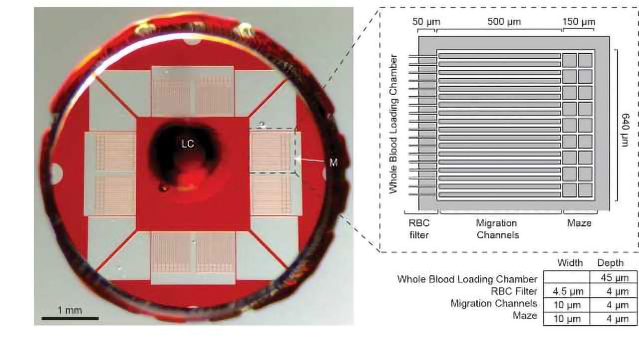 Measuring Neutrophil Motility Could Lead to Accurate Sepsis Diagnosis
