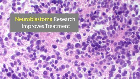 Neuroblastoma Biomarker Research Advances Treatment