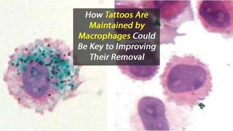 Macrophage's Role in Maintaining Tattoos Could Hold Key to Removal