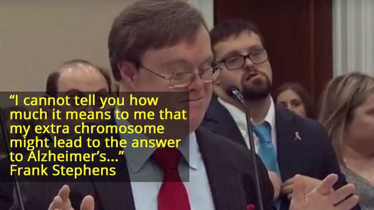 A Powerful Message About Down's Syndrome and Alzheimer's