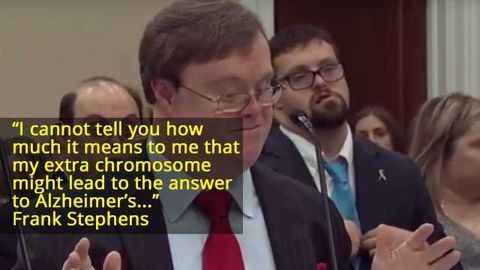 A Powerful Message About Down's Syndrome and Alzheimer's