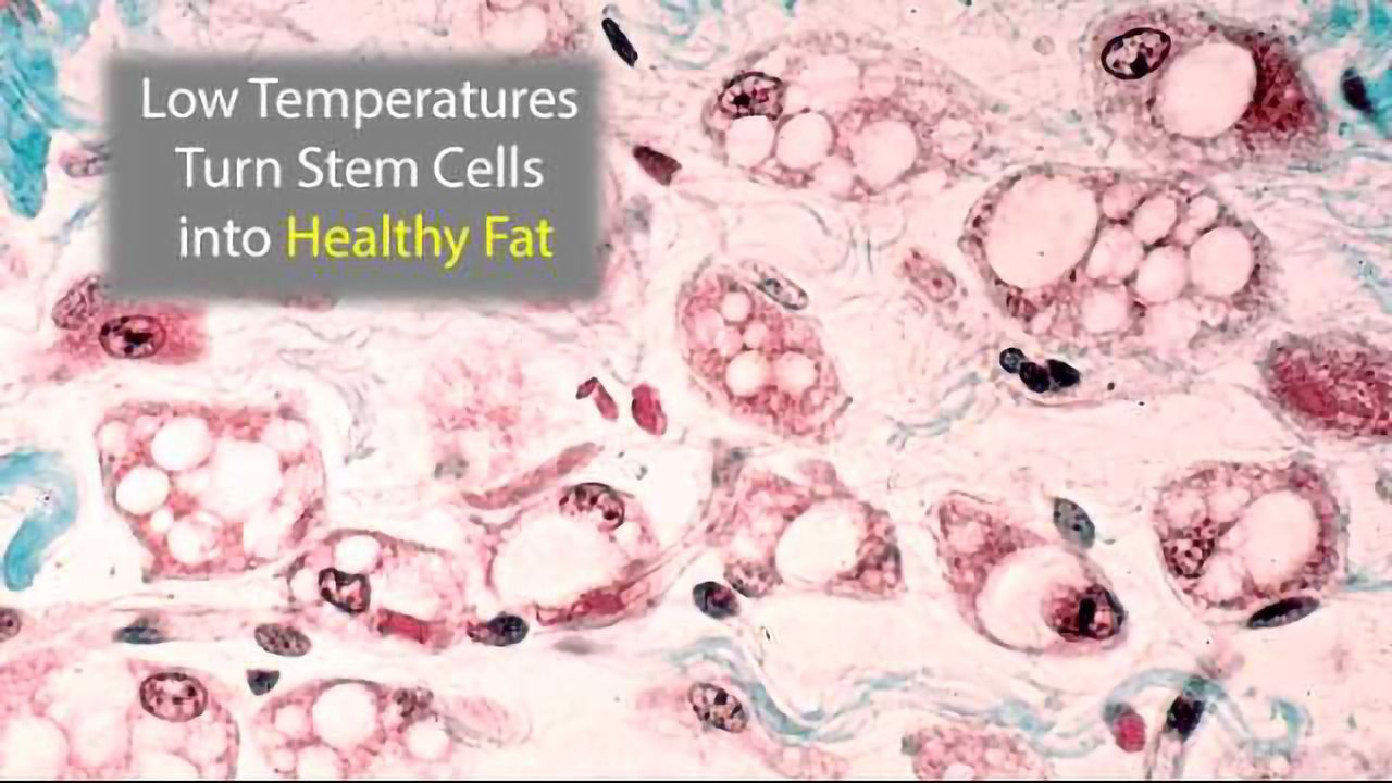 Low Temperatures Turn Stem Cells into Calorie-Burning Fat