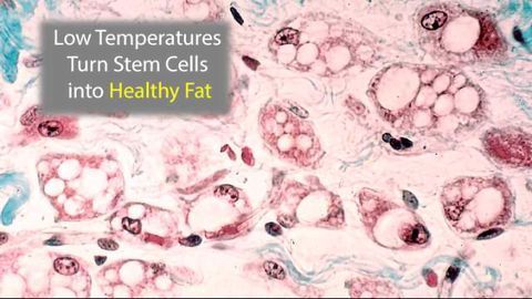 Low Temperatures Turn Stem Cells into Calorie-Burning Fat