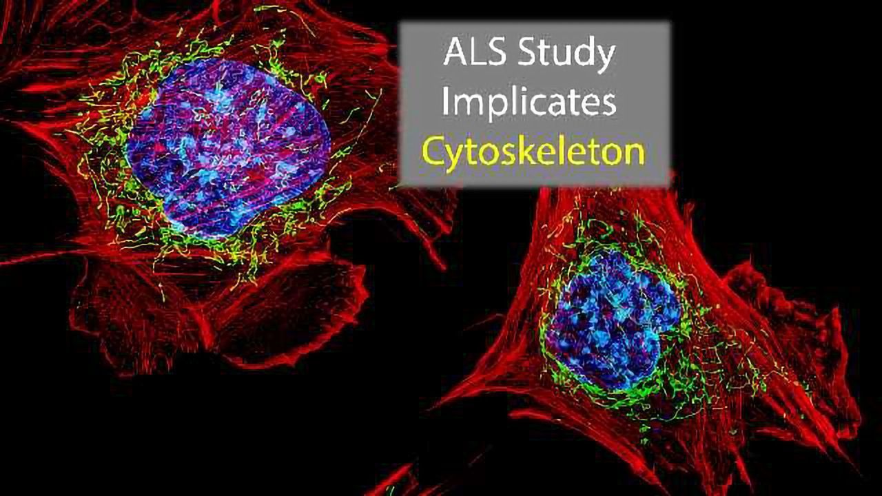 Cytoskeleton Implicated in ALS Gene Study