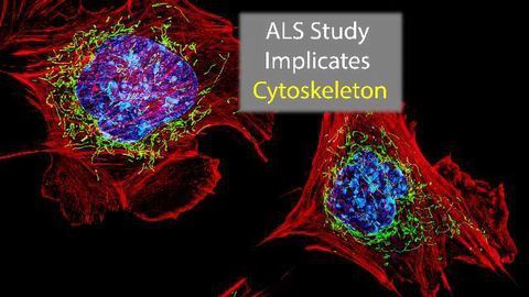 Cytoskeleton Implicated in ALS Gene Study