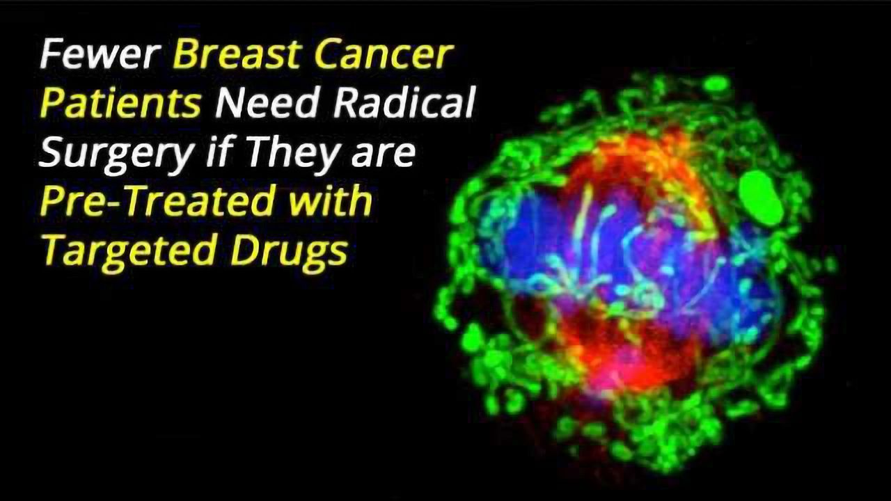 Pre-Treatment with Targeted Drugs Could Mean Less Breast Cancer Patients Require Radical Surgery
