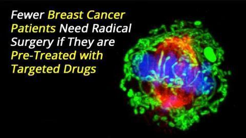 Pre-Treatment with Targeted Drugs Could Mean Less Breast Cancer Patients Require Radical Surgery