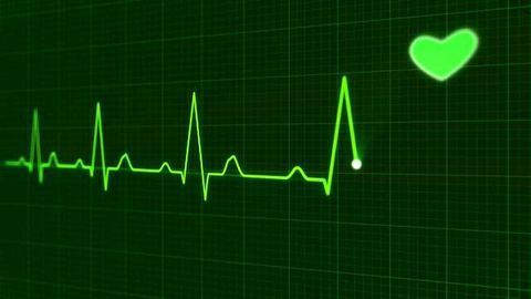 Study Supports Biomarker Assay for Diagnosis of Acute Heart Failure