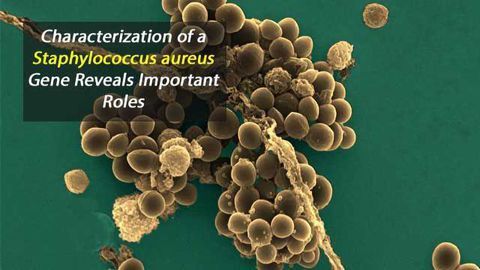 Staphylococcus aureus: A New Mechanism Involved in Virulence and Antibiotic Resistance