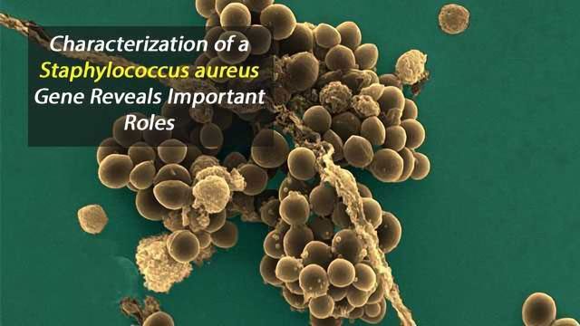 importance of staphylococcus aureus