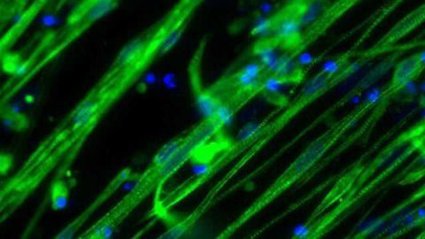 AMSBIO Signs Global Agreement for Groundbreaking Myotube Technology
