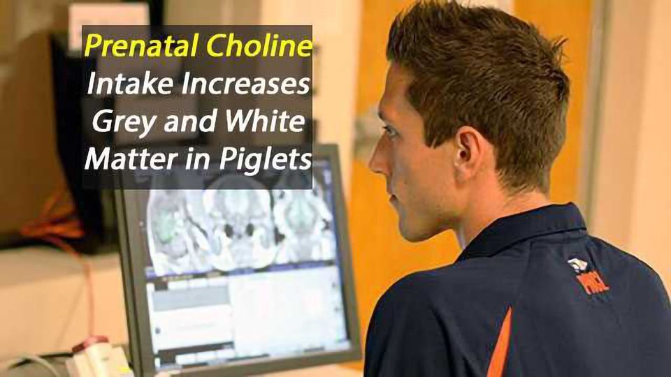 Prenatal Choline Intake Influences Fetal Development Technology Networks