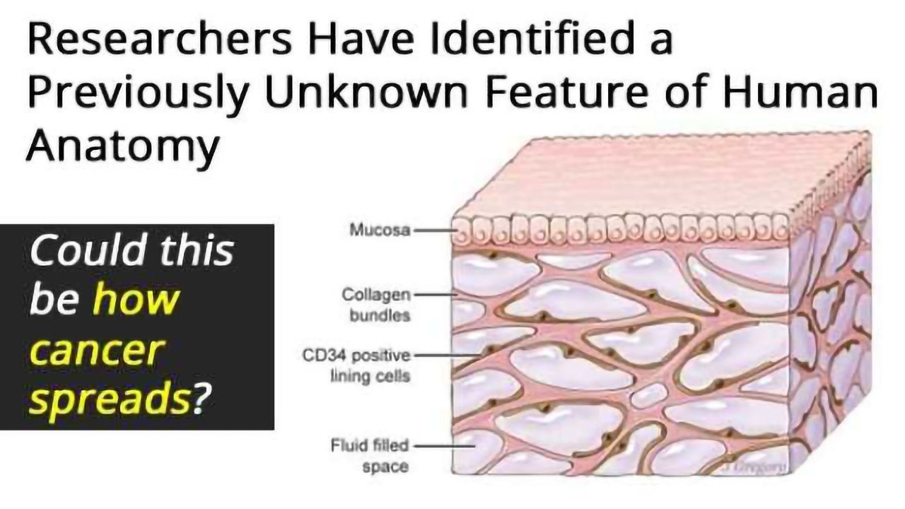 Newly-Discovered Human ‘Organ’: Could This be How Cancer Spreads?