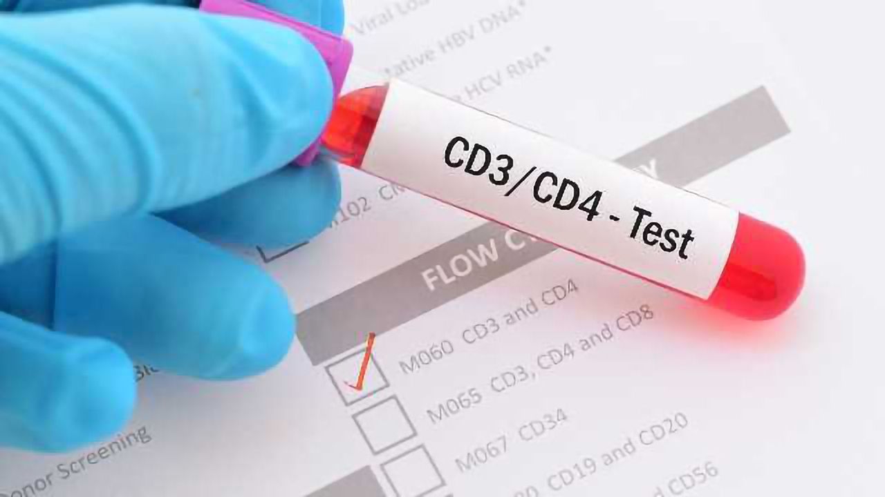 10 Tips to Optimize Clinical Flow Cytometry