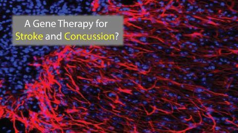 A New Gene Therapy for Brain Repair?