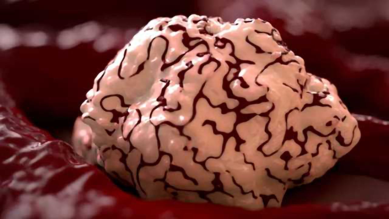 Tracking Cancer With A Blood Test