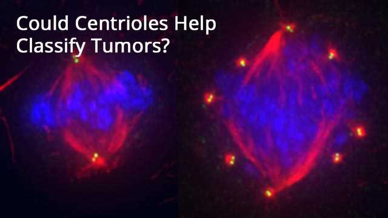 Could Centrioles Help Classify Tumors?