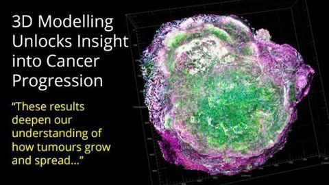 3D Modelling Provides Clearer Picture of Cancer Progression