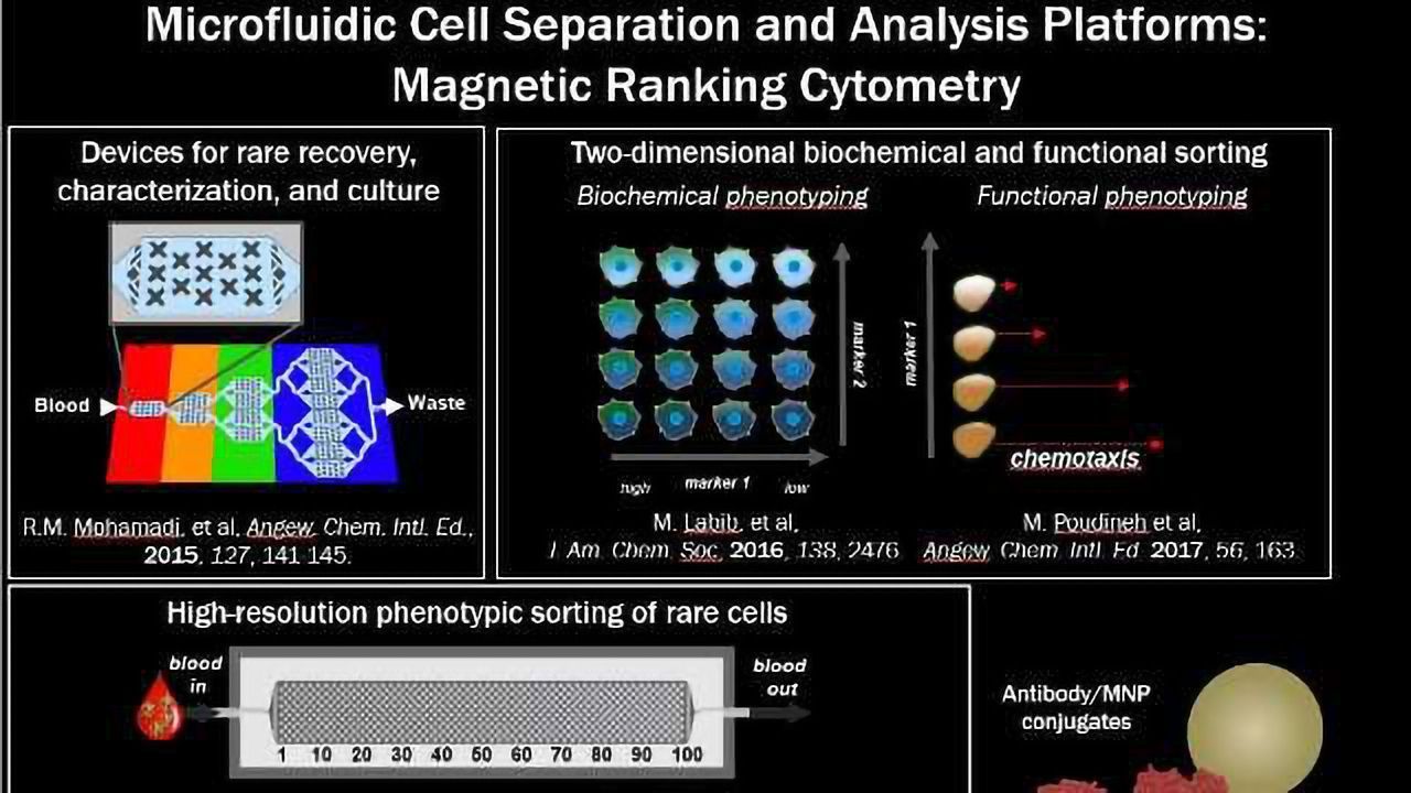 Liquid Biopsy Technology for Prostate Cancer Developed