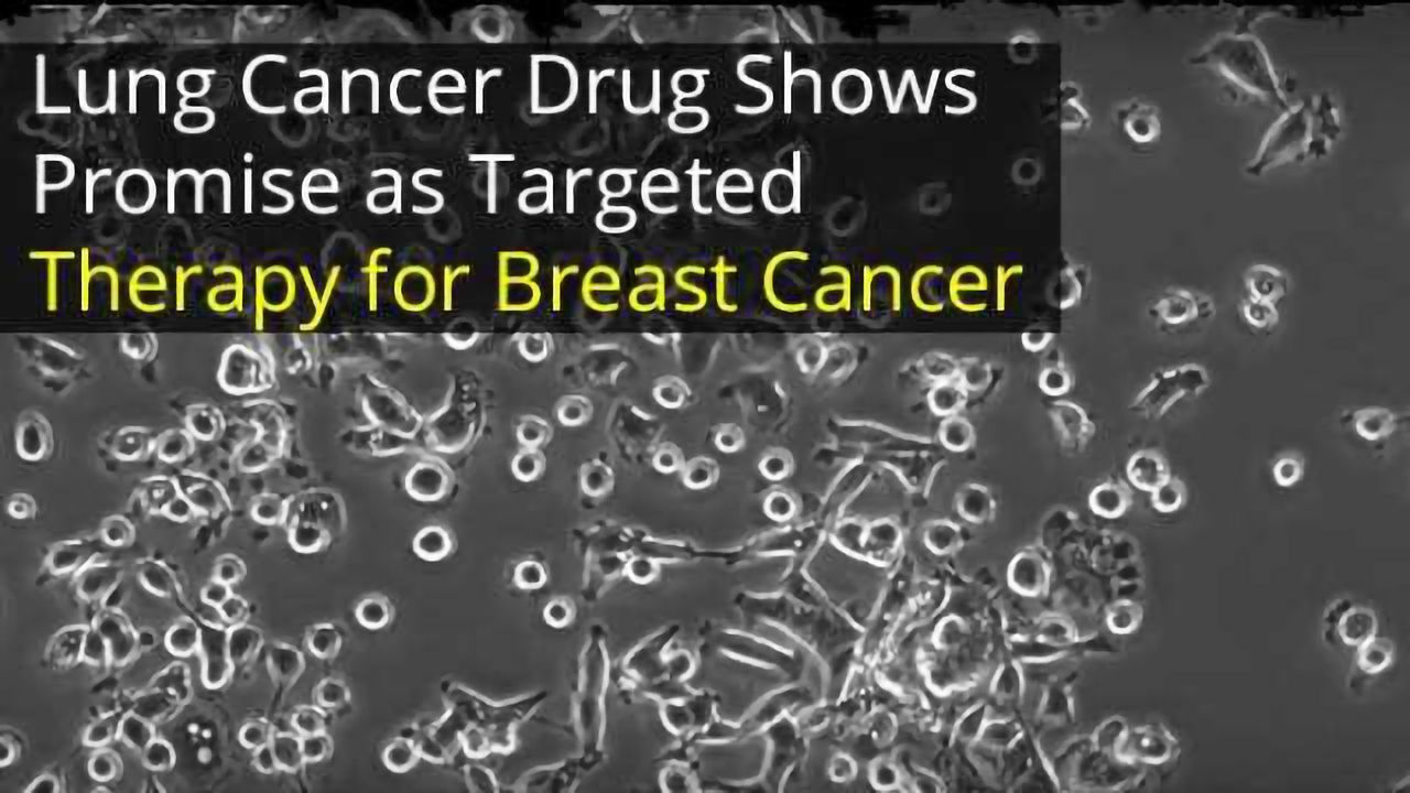 New Breast Cancer Therapy: Drug Targets Defects in Cancer Cell's 'Velcro'