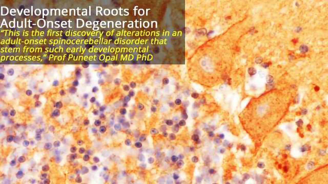 Adult-Onset Neurodegeneration Has Roots in Early Development