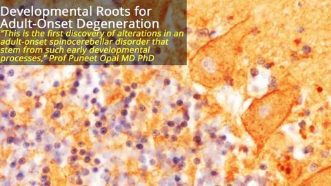Adult-Onset Neurodegeneration Has Roots in Early Development