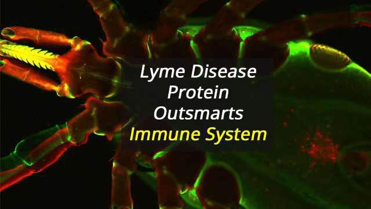 Protein Used to Outsmart the Human Immune System Uncovered