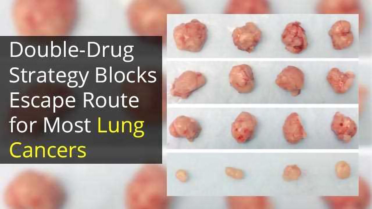 A One-Two Combo Punch for Lung Cancer