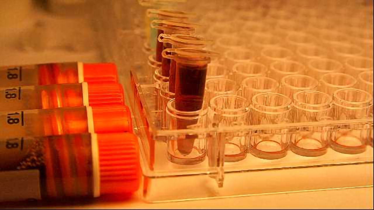 The Future for PCR Diagnostics