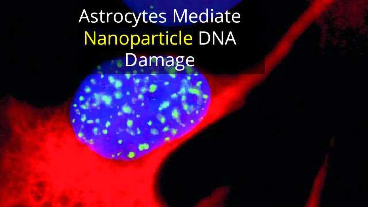Metal Nanoparticles Damage Brain DNA