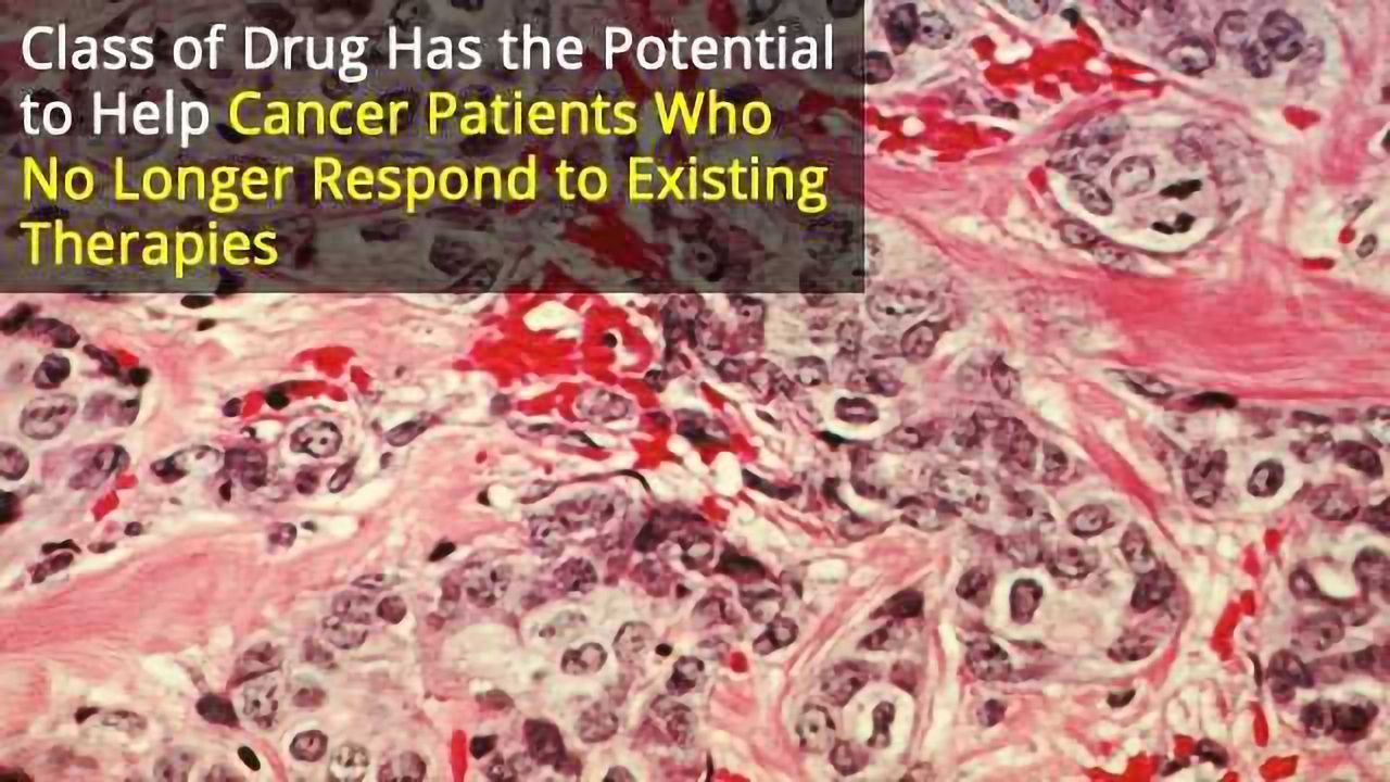 Class of Drugs Could Help Tackle Treatment-Resistant Cancers