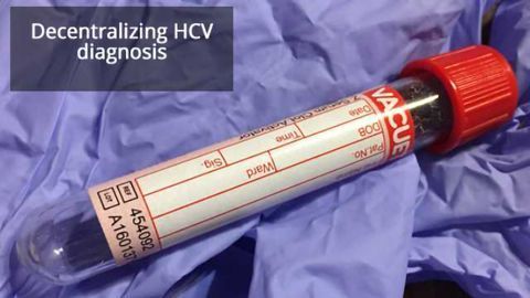 A Novel Point-of-Care Assay Developed for Hepatitis C