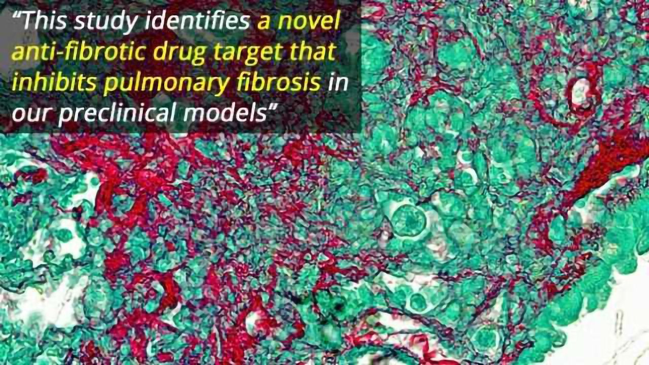 Molecular Target Identified for Treating Deadly Lung Disease