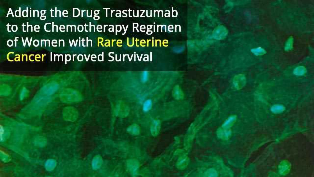 Drug Combo Improves Survival of Women with Rare Uterine Cancer