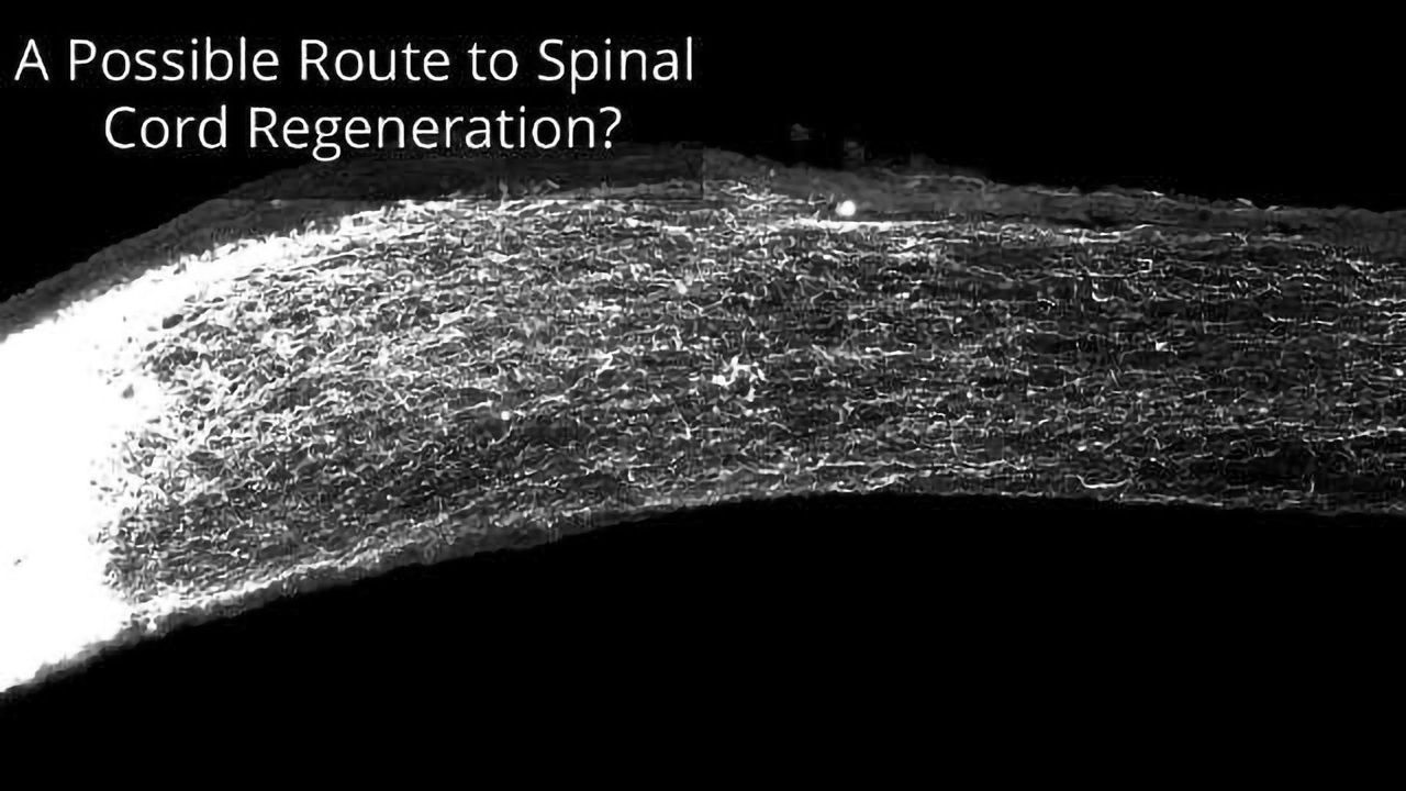 Single Gene Elimination Prompts Nerve Cell Regeneration