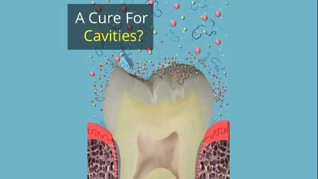 Curing Cavities With Peptide Products