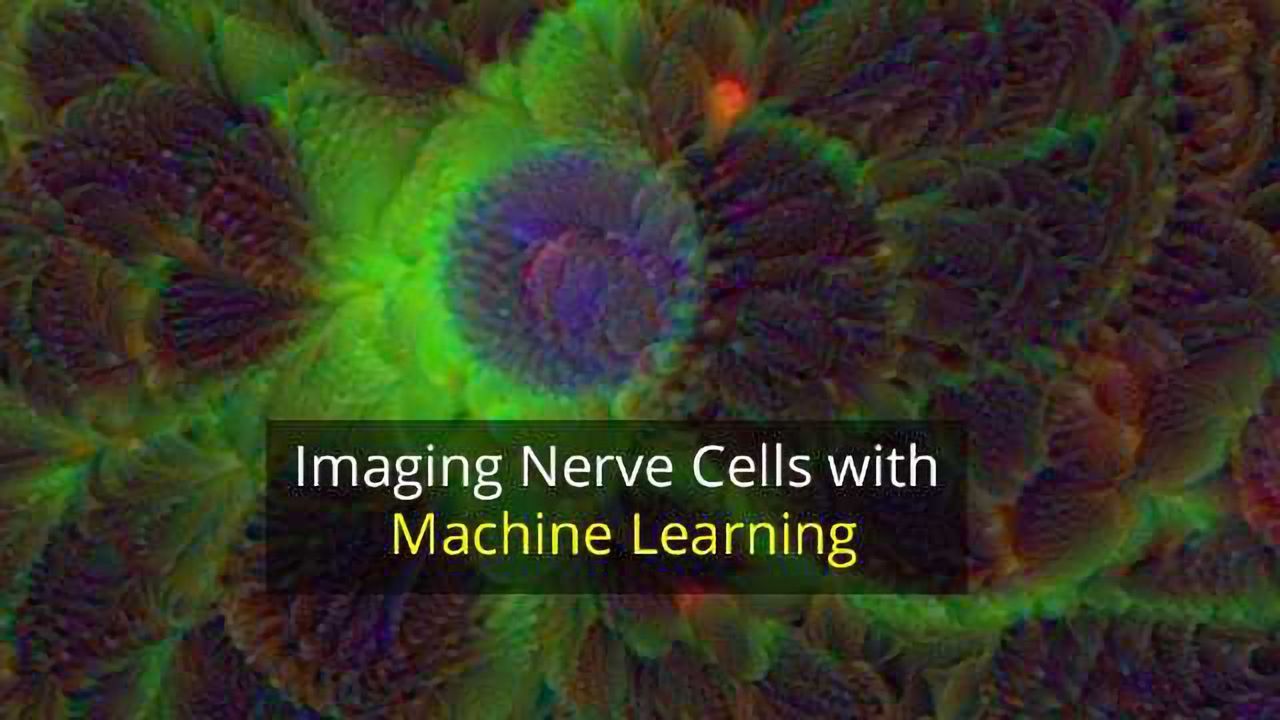 Training Computers to Trace Brain Cells