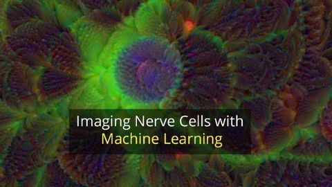Training Computers to Trace Brain Cells