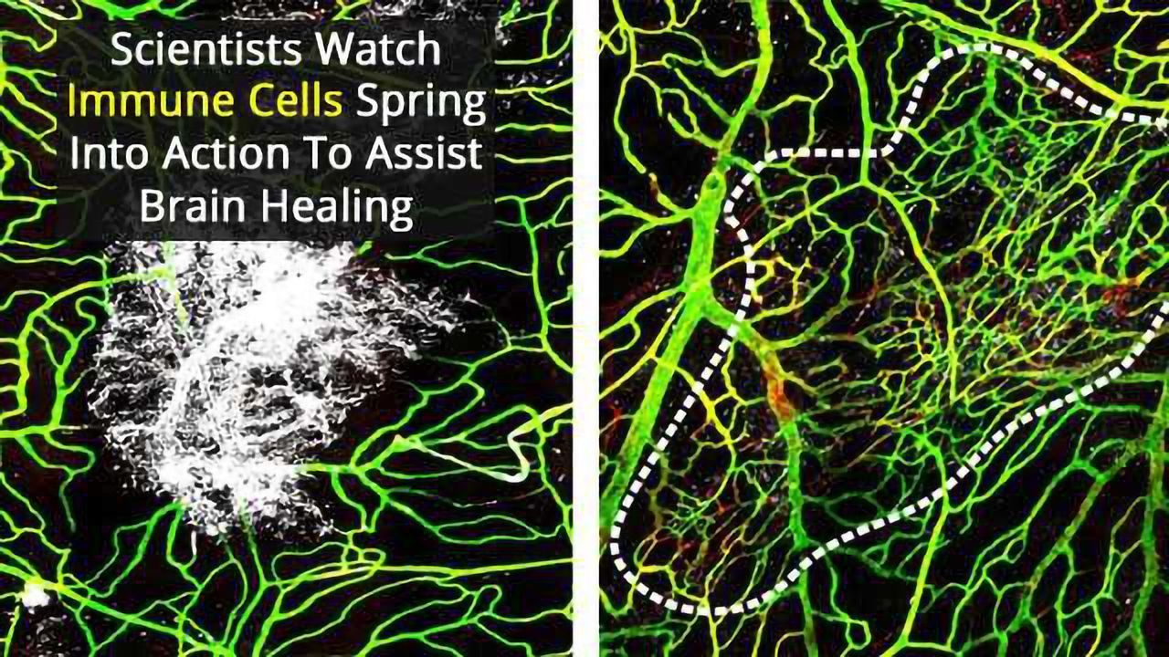 Insights Into the Immune System’s Role Following Traumatic Brain Injury