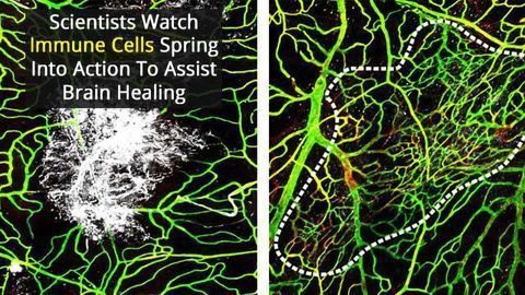 Insights Into the Immune System’s Role Following Traumatic Brain Injury