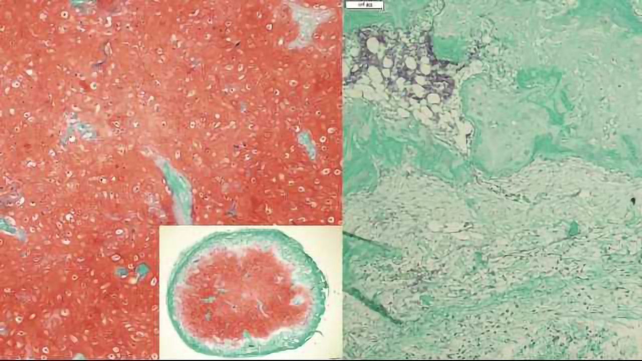 Cartilage Cultivated From Stem Cells