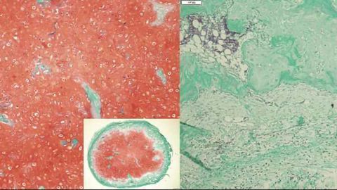 Cartilage Cultivated From Stem Cells